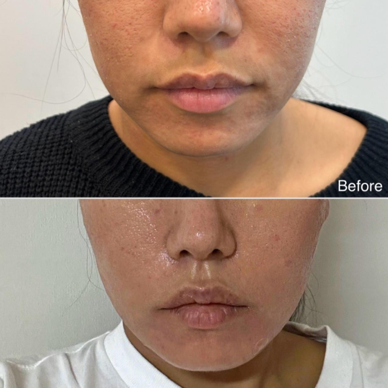 올리디아(팔자)